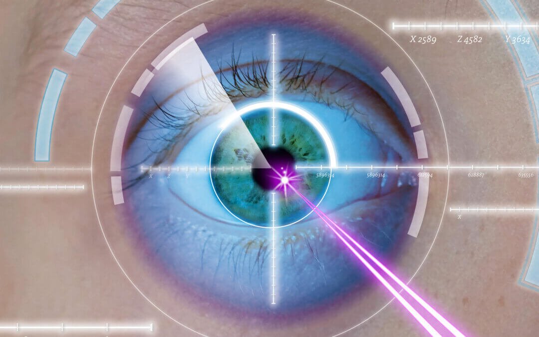 Chirurgie LASIK : le guide pratique pour comprendre votre opération de la vision