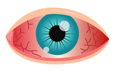 Comment reconnaître une urgence ophtalmologique ?