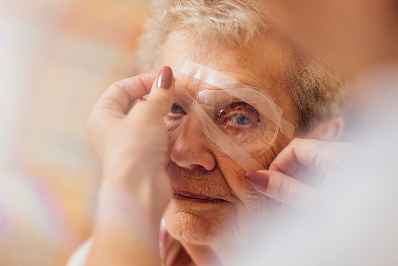 pose d'une protection oculaire à une patiente ayant bénéficiée d'une chirurgie de la cataracte